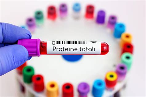 Proteine nel sangue per la diagnosi precoce del cancro: una rivoluzione imminente