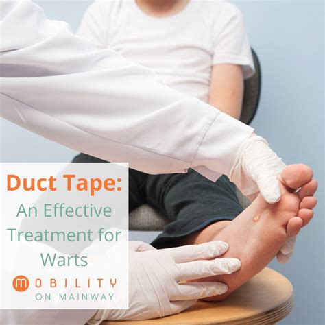 Unveiling the Truth Behind Wart Treatments: From Duct Tape to Cryotherapy