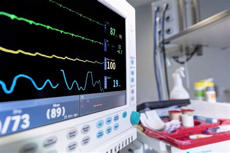 Desmistificando a Monitorização de Heartbeat em Serviços Online