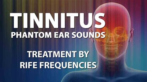 New Discoveries in Tinnitus Research: Real or Phantom Sounds?